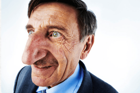 Mehmet-Ozyurek-longest-nose-in-world